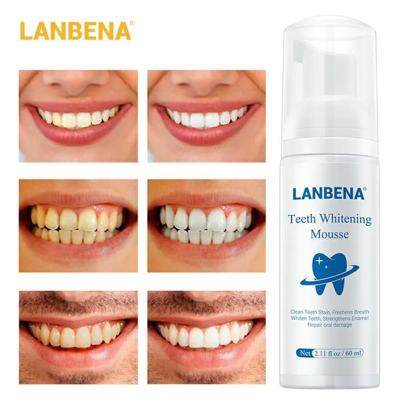 Lanbena Teeth Whitening Mousse - 60ml